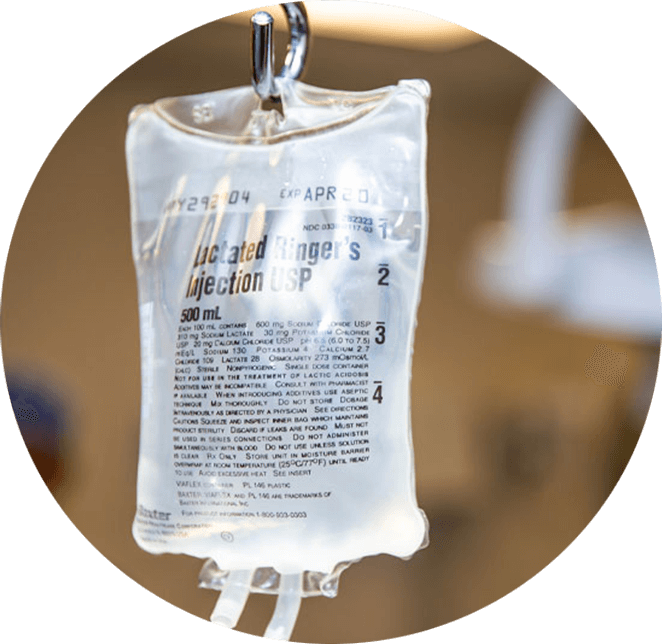 IV sedation example model