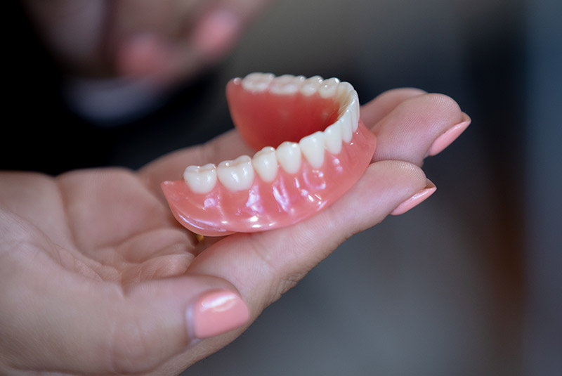 Traditional dentures example model