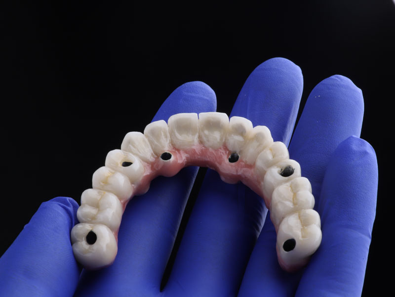 Navigating the World of Dental Implant Surgery in Pine Bush, NY